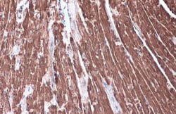Invitrogen HK2 Polyclonal Antibody 100 &mu;L; Unconjugated:Antibodies,