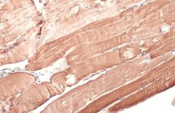 Invitrogen HK2 Polyclonal Antibody 100 &mu;L; Unconjugated:Antibodies,