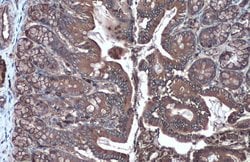 Invitrogen HK2 Polyclonal Antibody 100 &mu;L; Unconjugated:Antibodies,