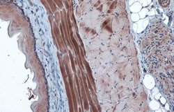 Invitrogen HK2 Polyclonal Antibody 100 &mu;L; Unconjugated:Antibodies,