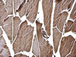 Invitrogen HK2 Polyclonal Antibody 100 &mu;L; Unconjugated:Antibodies,
