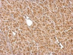 Invitrogen HK2 Polyclonal Antibody 100 &mu;L; Unconjugated:Antibodies,