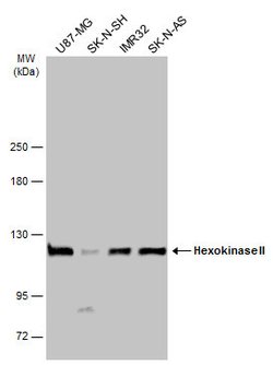 Invitrogen HK2 Polyclonal Antibody 100 &mu;L; Unconjugated:Antibodies,