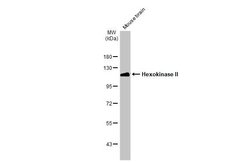 Invitrogen HK2 Polyclonal Antibody 100 &mu;L; Unconjugated:Antibodies,