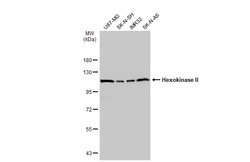 Invitrogen HK2 Polyclonal Antibody 100 &mu;L; Unconjugated:Antibodies,