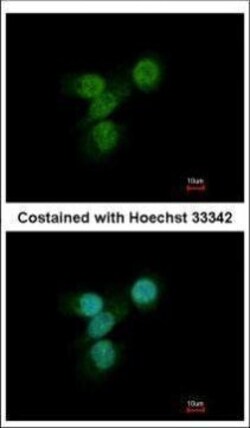 Invitrogen Lyn Polyclonal Antibody 100 &mu;L; Unconjugated:Antibodies,