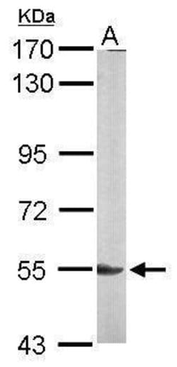 Invitrogen Lyn Polyclonal Antibody 100 &mu;L; Unconjugated:Antibodies,