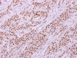 Invitrogen Lyn Polyclonal Antibody 100 &mu;L; Unconjugated:Antibodies,