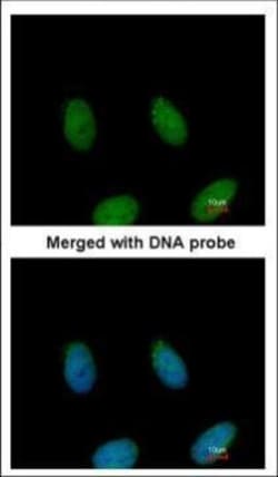 Invitrogen FAF1 Polyclonal Antibody 100 &mu;L | Buy Online | Invitrogen&trade; | Fisher Scientific