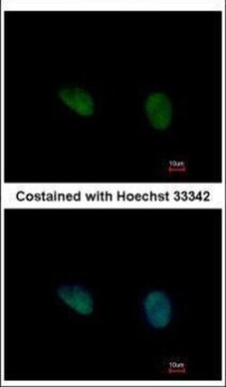 Invitrogen PHKG2 Polyclonal Antibody 100 μL; Unconjugated:Antibodies,