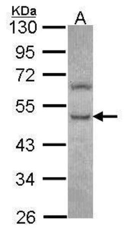 Invitrogen PHKG2 Polyclonal Antibody 100 μL; Unconjugated:Antibodies,