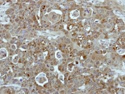 Invitrogen BCR Polyclonal Antibody 100 &mu;L; Unconjugated:Antibodies,