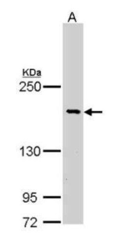 Invitrogen BCR Polyclonal Antibody 100 &mu;L; Unconjugated:Antibodies,
