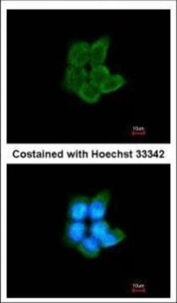 Invitrogen PFKM Polyclonal Antibody 100 &mu;L; Unconjugated:Antibodies,