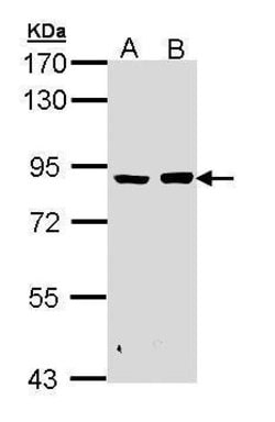 Invitrogen PFKM Polyclonal Antibody 100 &mu;L; Unconjugated:Antibodies,