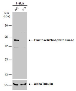 Invitrogen PFKM Polyclonal Antibody 100 &mu;L; Unconjugated:Antibodies,