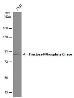 Invitrogen PFKM Polyclonal Antibody 100 &mu;L; Unconjugated:Antibodies,