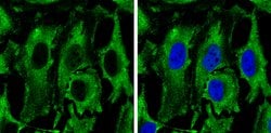 Invitrogen PKM2 Polyclonal Antibody 100 μL; Unconjugated:Antibodies,