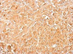 Invitrogen PKM2 Polyclonal Antibody 100 μL; Unconjugated:Antibodies,