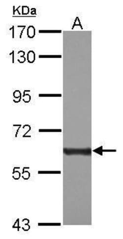 Invitrogen PKM2 Polyclonal Antibody 100 μL; Unconjugated:Antibodies,