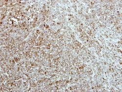 Invitrogen CKMT2 Polyclonal Antibody 100 &mu;L; Unconjugated:Antibodies,