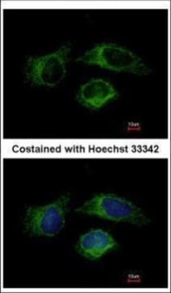 Invitrogen Caspase 1 Polyclonal Antibody 100 &mu;L; Unconjugated:Antibodies,