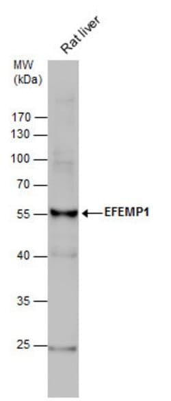 Invitrogen Fibulin 3 Polyclonal Antibody 100 &mu;L; Unconjugated:Antibodies,