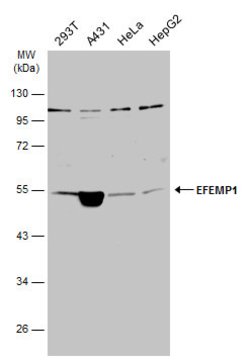 Invitrogen Fibulin 3 Polyclonal Antibody 100 &mu;L; Unconjugated:Antibodies,