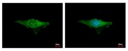 Invitrogen IDE Polyclonal Antibody 100 &mu;L; Unconjugated:Antibodies,
