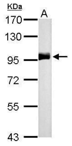 Invitrogen CD10 Polyclonal Antibody 100 &mu;L; Unconjugated:Antibodies,