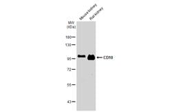 Invitrogen CD10 Polyclonal Antibody 100 &mu;L; Unconjugated:Antibodies,