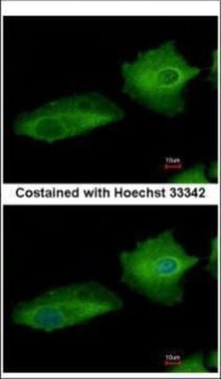 Invitrogen TGM2 Polyclonal Antibody 100 &mu;L; Unconjugated:Antibodies,