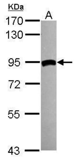 Invitrogen TGM2 Polyclonal Antibody 100 &mu;L; Unconjugated:Antibodies,