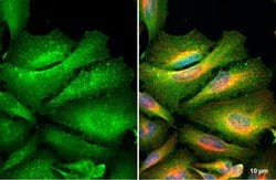 Invitrogen Ezrin Polyclonal Antibody 100 &mu;L; Unconjugated:Antibodies,
