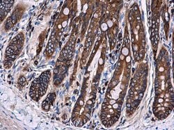 Invitrogen Ezrin Polyclonal Antibody 100 &mu;L; Unconjugated:Antibodies,