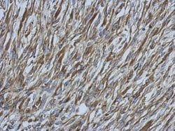 Invitrogen Ezrin Polyclonal Antibody 100 &mu;L; Unconjugated:Antibodies,