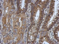 Invitrogen Ezrin Polyclonal Antibody 100 &mu;L; Unconjugated:Antibodies,