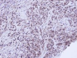 Invitrogen XRCC1 Polyclonal Antibody 100 &mu;L; Unconjugated:Antibodies,