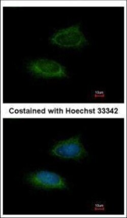 Invitrogen Adenylate Kinase 2 Polyclonal Antibody 100 &mu;L; Unconjugated:Antibodies,