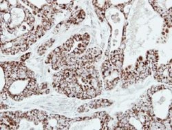 Invitrogen Adenylate Kinase 2 Polyclonal Antibody 100 &mu;L; Unconjugated:Antibodies,
