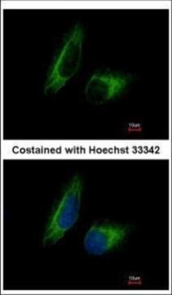Invitrogen PFKFB1 Polyclonal Antibody 100 &mu;L; Unconjugated:Antibodies,