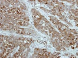 Invitrogen PFKFB1 Polyclonal Antibody 100 &mu;L; Unconjugated:Antibodies,