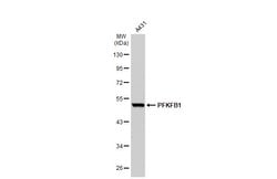 Invitrogen PFKFB1 Polyclonal Antibody 100 &mu;L; Unconjugated:Antibodies,