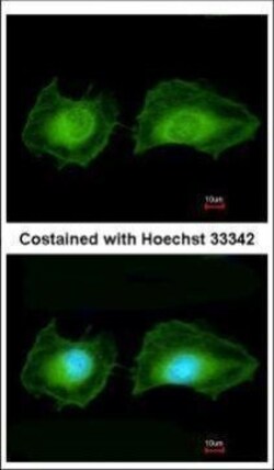 Invitrogen SGK3 Polyclonal Antibody 100 &mu;L; Unconjugated:Antibodies,