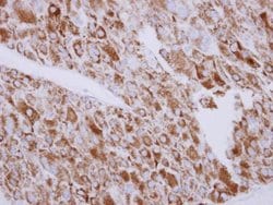 Invitrogen SGK3 Polyclonal Antibody 100 &mu;L; Unconjugated:Antibodies,
