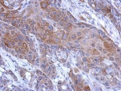 Invitrogen Calpain 2 Polyclonal Antibody 100 &mu;L | Buy Online | Invitrogen&trade; | Fisher Scientific