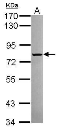 Invitrogen Calpain 2 Polyclonal Antibody 100 &mu;L | Buy Online | Invitrogen&trade; | Fisher Scientific