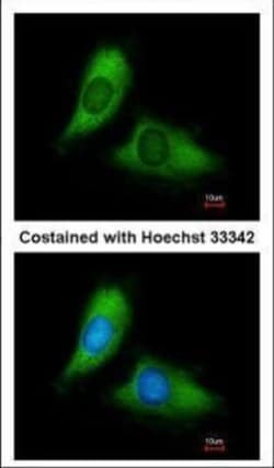 Invitrogen BNIP3L Polyclonal Antibody 100 &mu;L | Buy Online | Invitrogen&trade; | Fisher Scientific