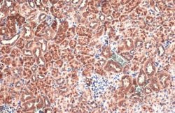 Invitrogen BNIP3L Polyclonal Antibody 100 &mu;L; Unconjugated:Antibodies,