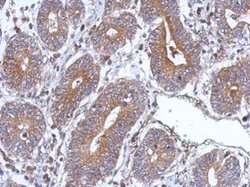 Invitrogen BNIP3L Polyclonal Antibody 100 &mu;L; Unconjugated:Antibodies,